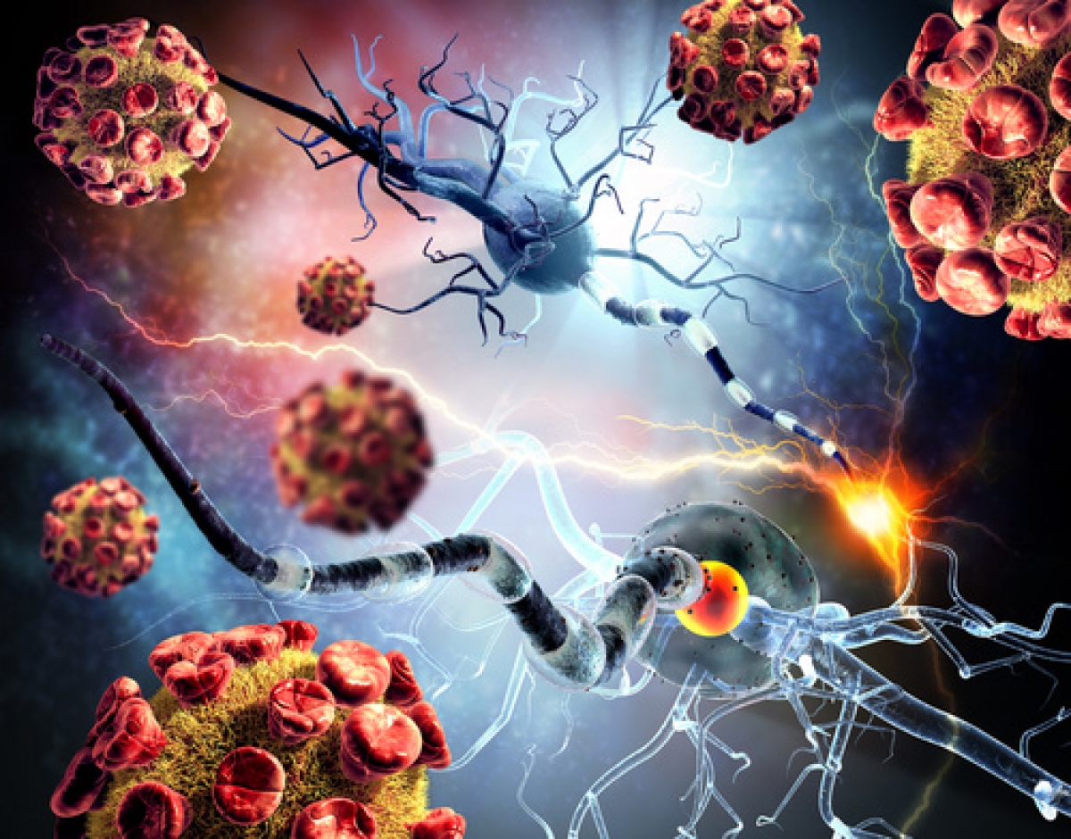 Enfermedades Neurodegenerativas Y Medicina Antienvejecimiento Cenegenics